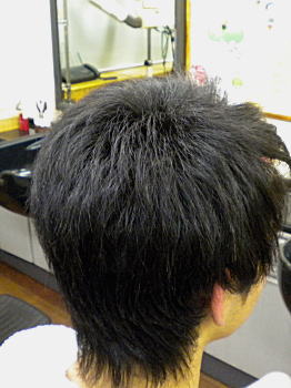 施術後・・・ 施術後・・・